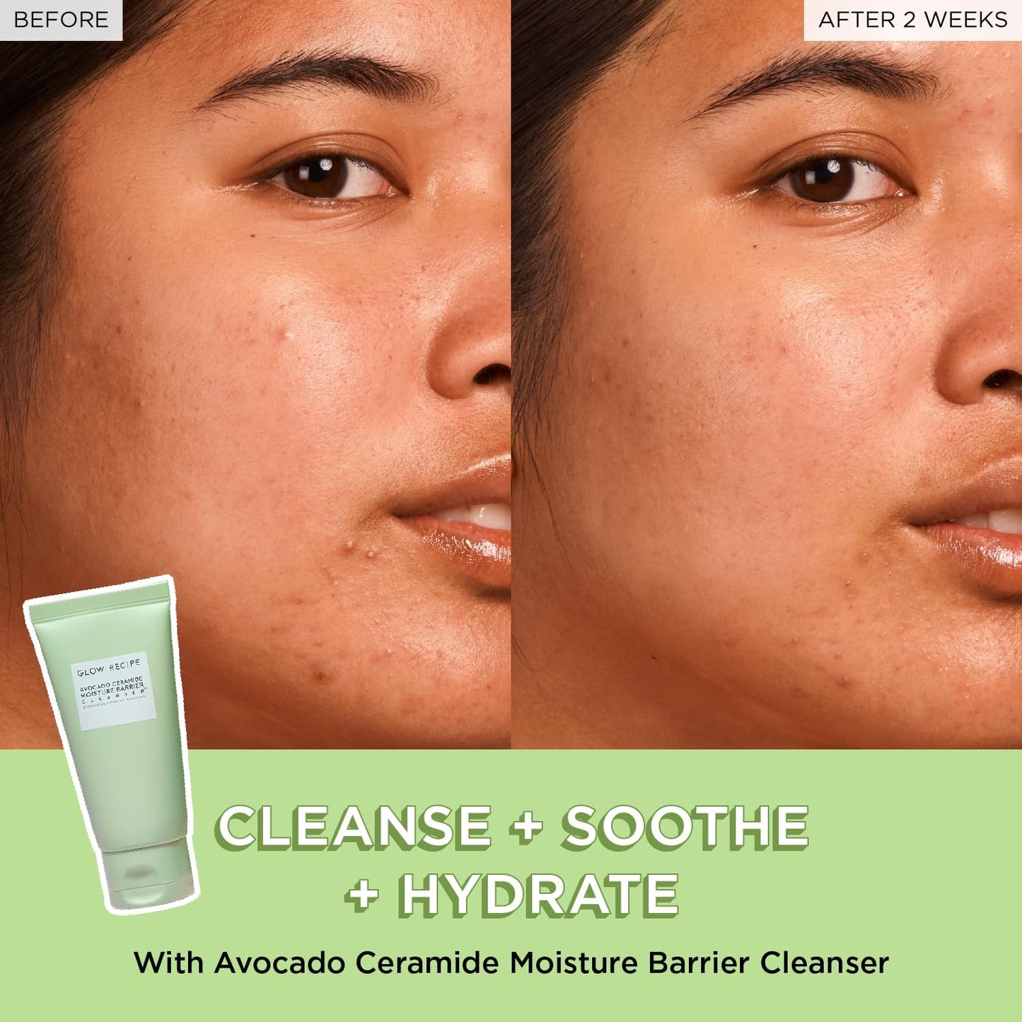 Glow Recipe Avocado Cleanser - Limpiador facial con barrera de humedad y ceramida de aguacate - 150ml